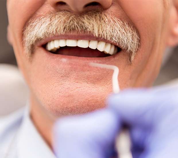 Chino Adjusting to New Dentures