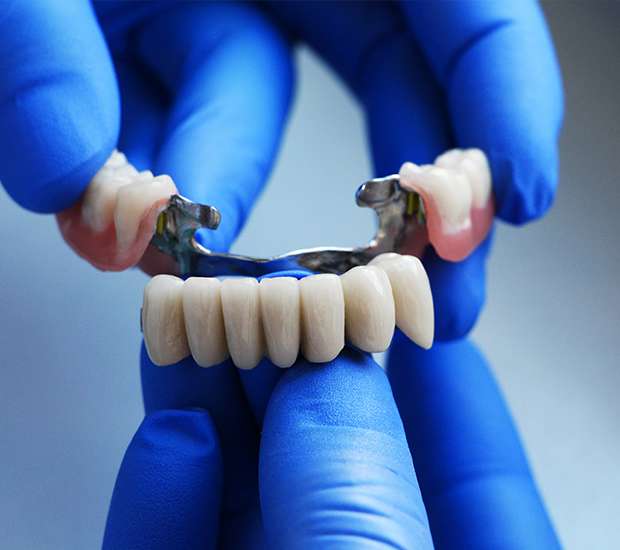 Chino Dental Bridges