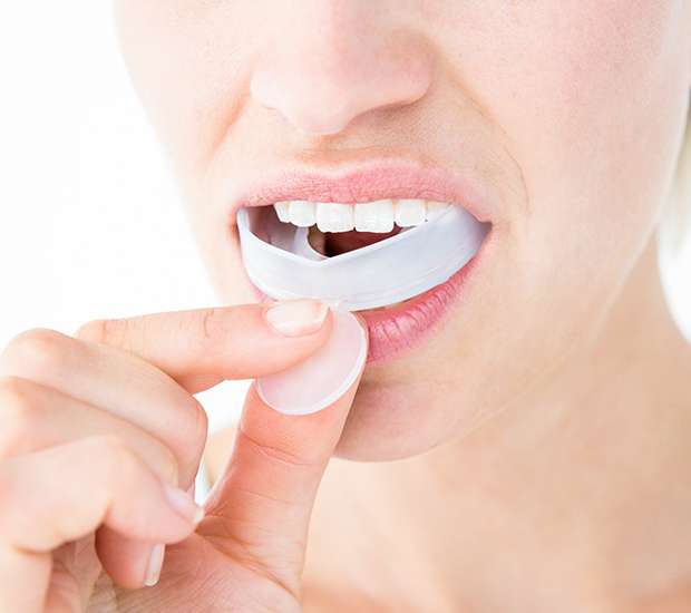 Chino Mouth Guards